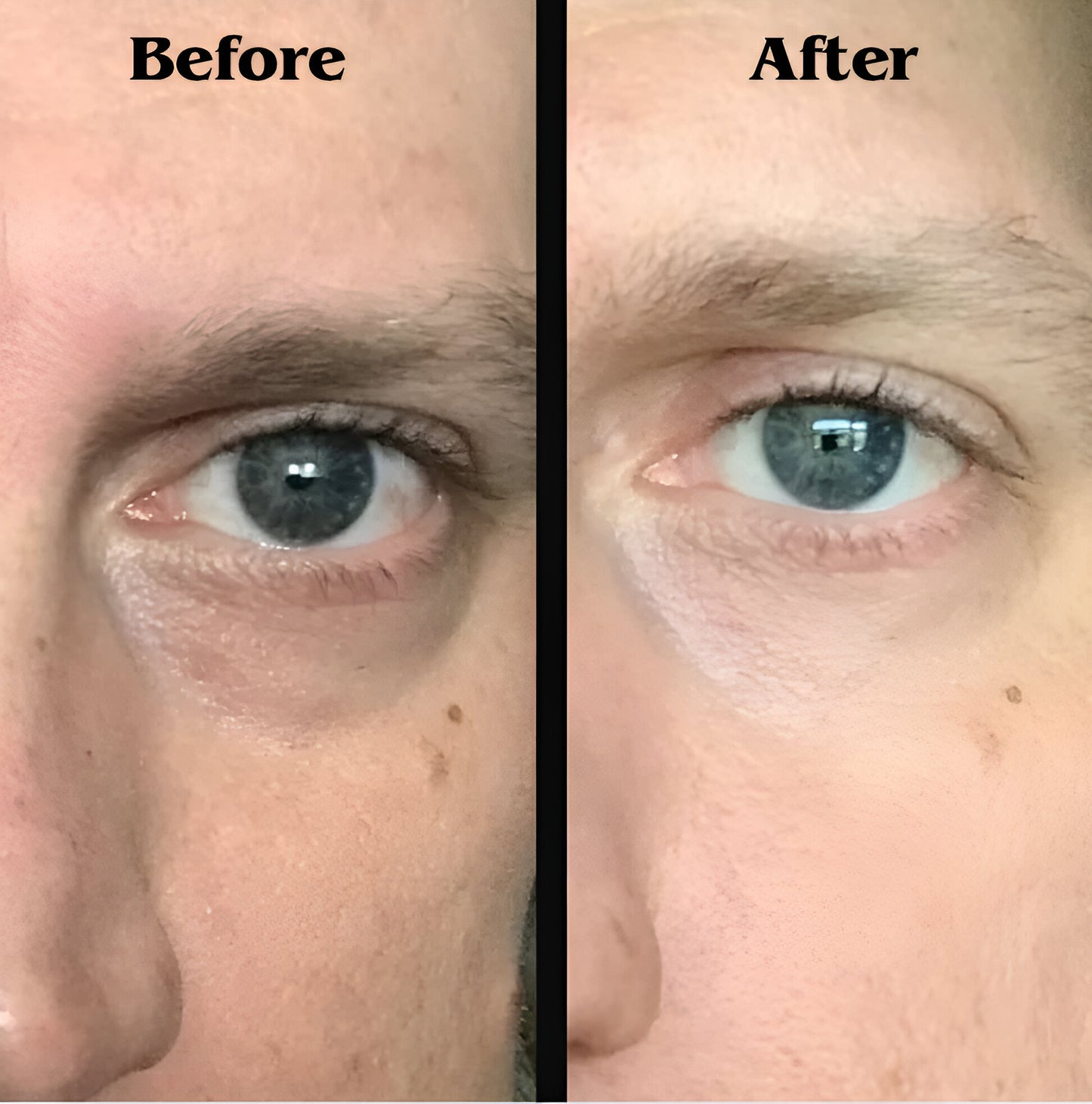 Adora Milano 3-in-1 Eye Cream for Men
