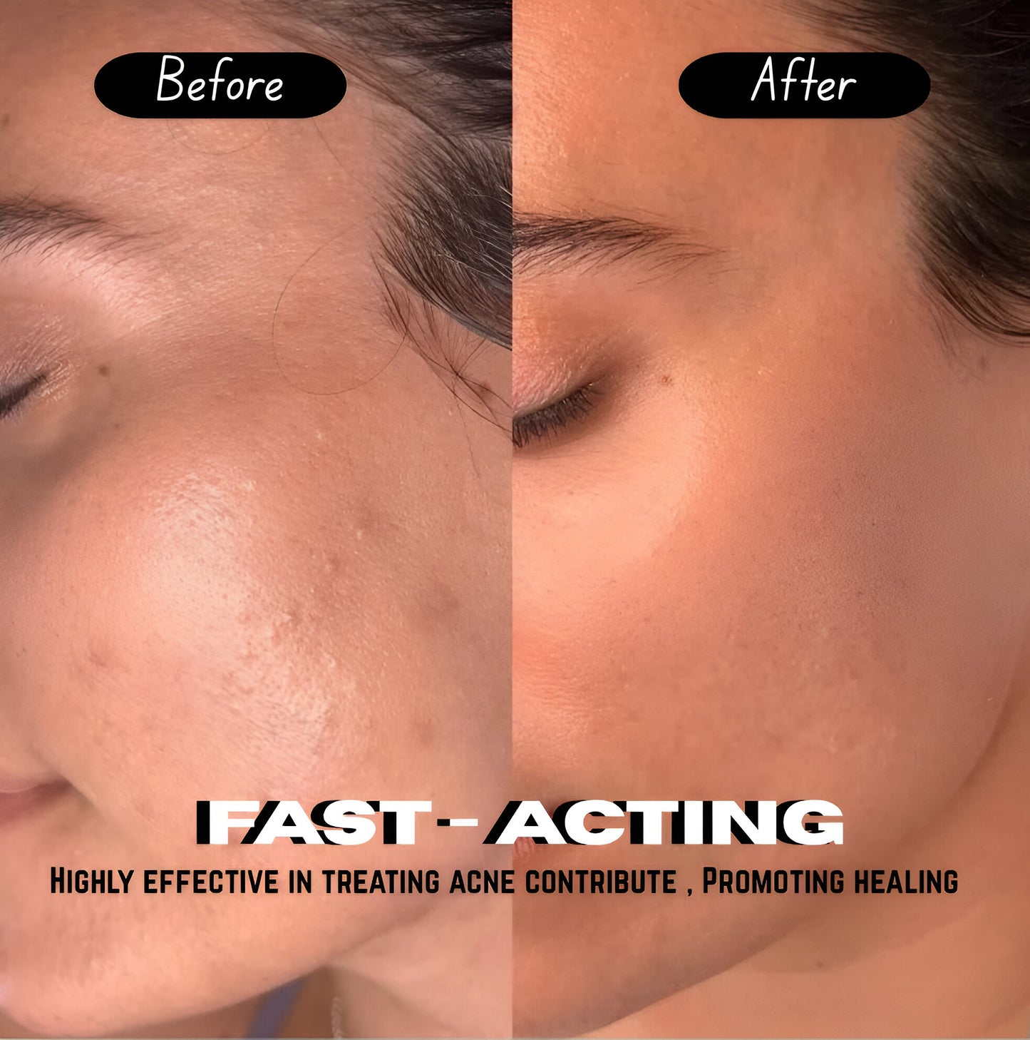 Adora Milano Acne Spot Care oily